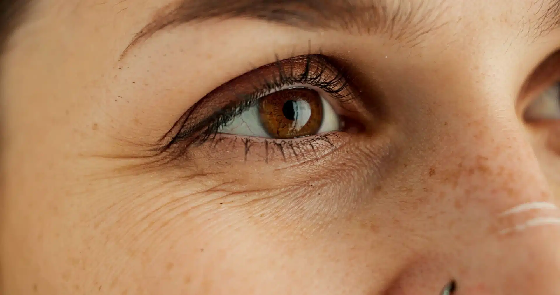 Primer plano del ojo marrón de una mujer con pecas, imagen simbólica sobre Eliminar patas de gallo en BONITAS Núremberg