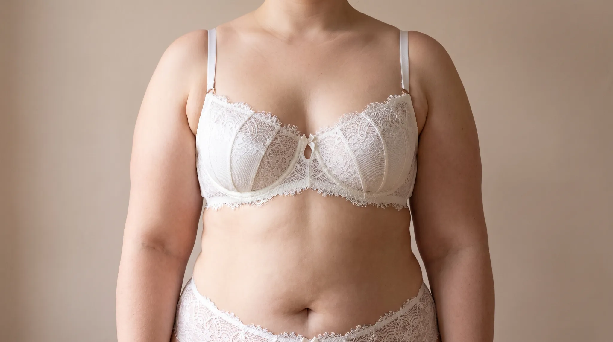 Torso de una mujer con brazos claramente engrosados, con lencería de encaje color crema, imagen simbólica sobre el lipedema en los brazos en BONITAS Núremberg