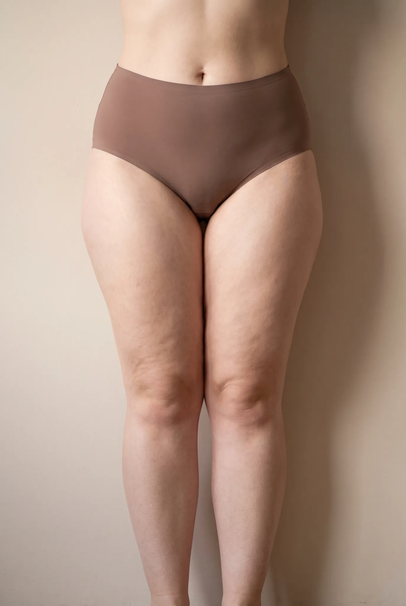 Narrow waist and column shaped thickened legs of a woman against a beige wall, symbolic image on the subject of lipoedema despite a slim figure at BONITAS in Nuremberg