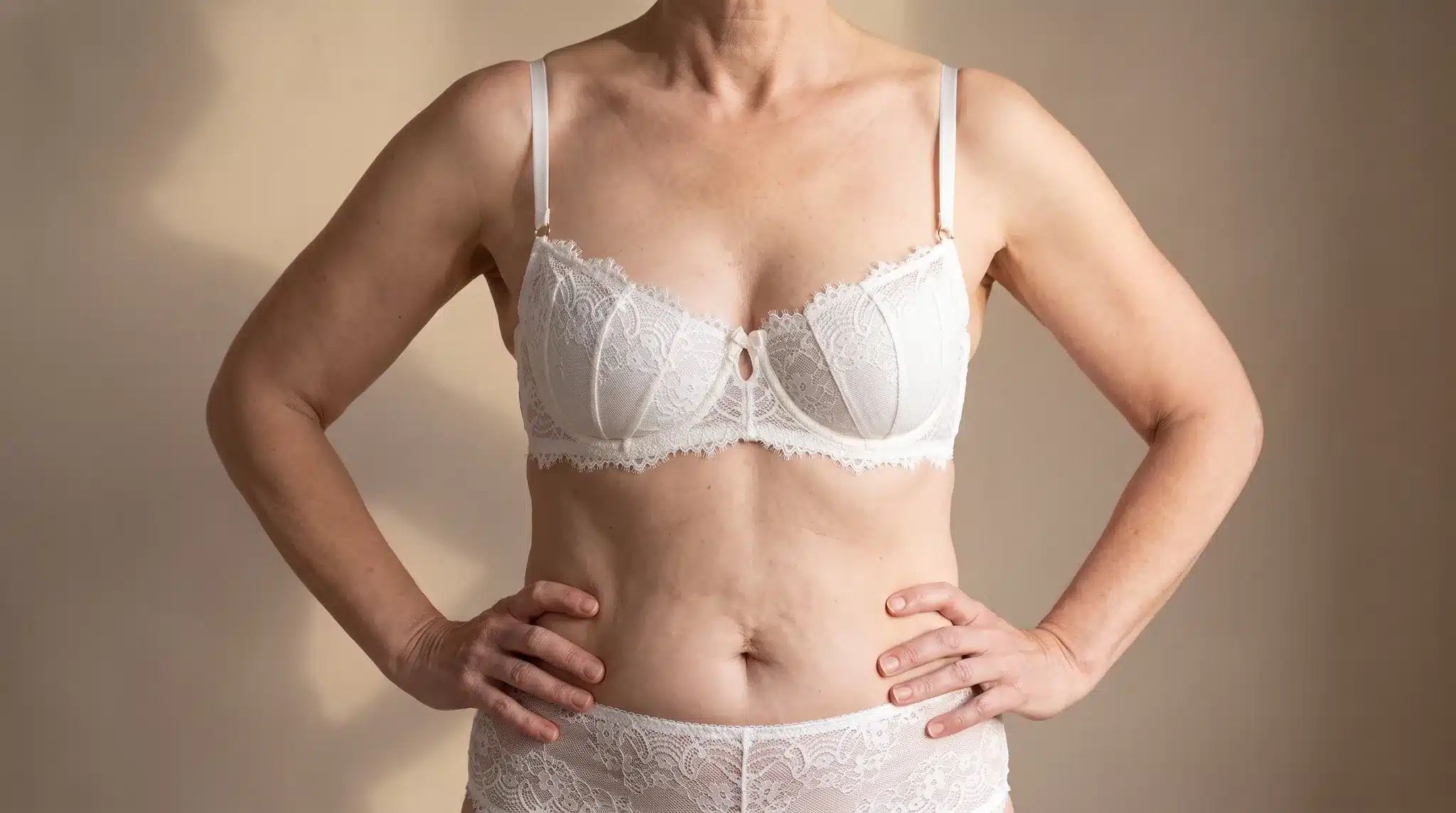 Oberkörper einer Frau mit tief sitzender, entleerter Brust und flachem oberen Dekolleté, in cremefarbener Spitzenwäsche, Symbolbild zum Thema Ursachen der Hängebrust bei BONITAS in Nürnberg
