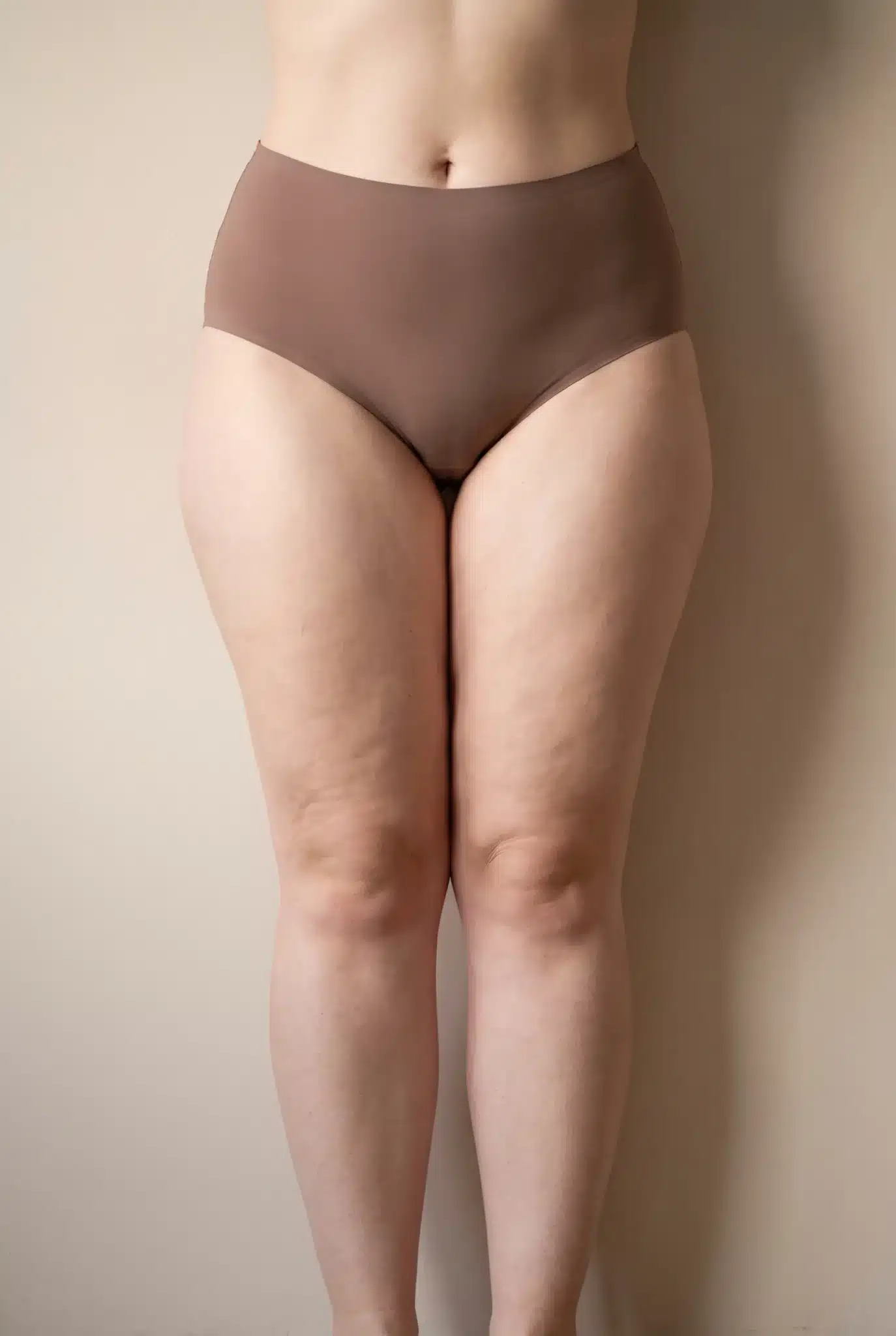 Cintura estrecha y piernas engrosadas en columna ante una pared beige, imagen simbólica sobre el lipedema en una figura delgada en BONITAS Núremberg